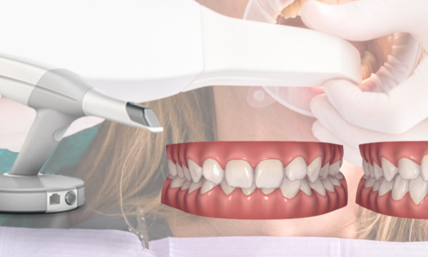 escaner intraoral